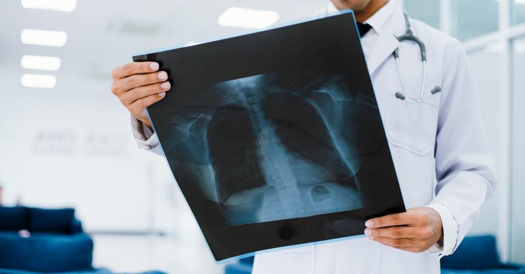 radiology doctor examining chest x ray film patient health care clinic