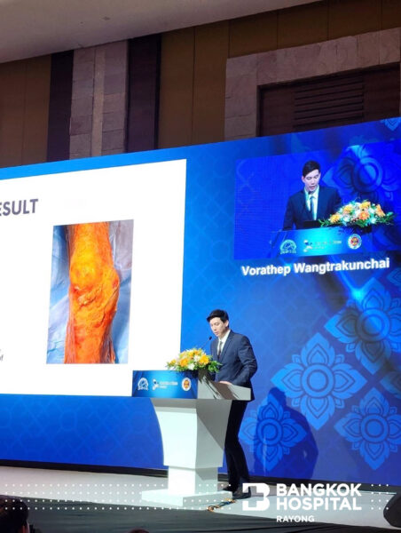 นายแพทย์ วรเทพ หวังตระกูลชัย ศัลยแพทย์ออร์โธปิดิกส์ ผลงานวิจัยในหัวข้อ "การลงแผลผ่าตัดข้อเข่าเทียมแบบใหม่" โดย โรงพยาบาลกรุงเทพระยอง