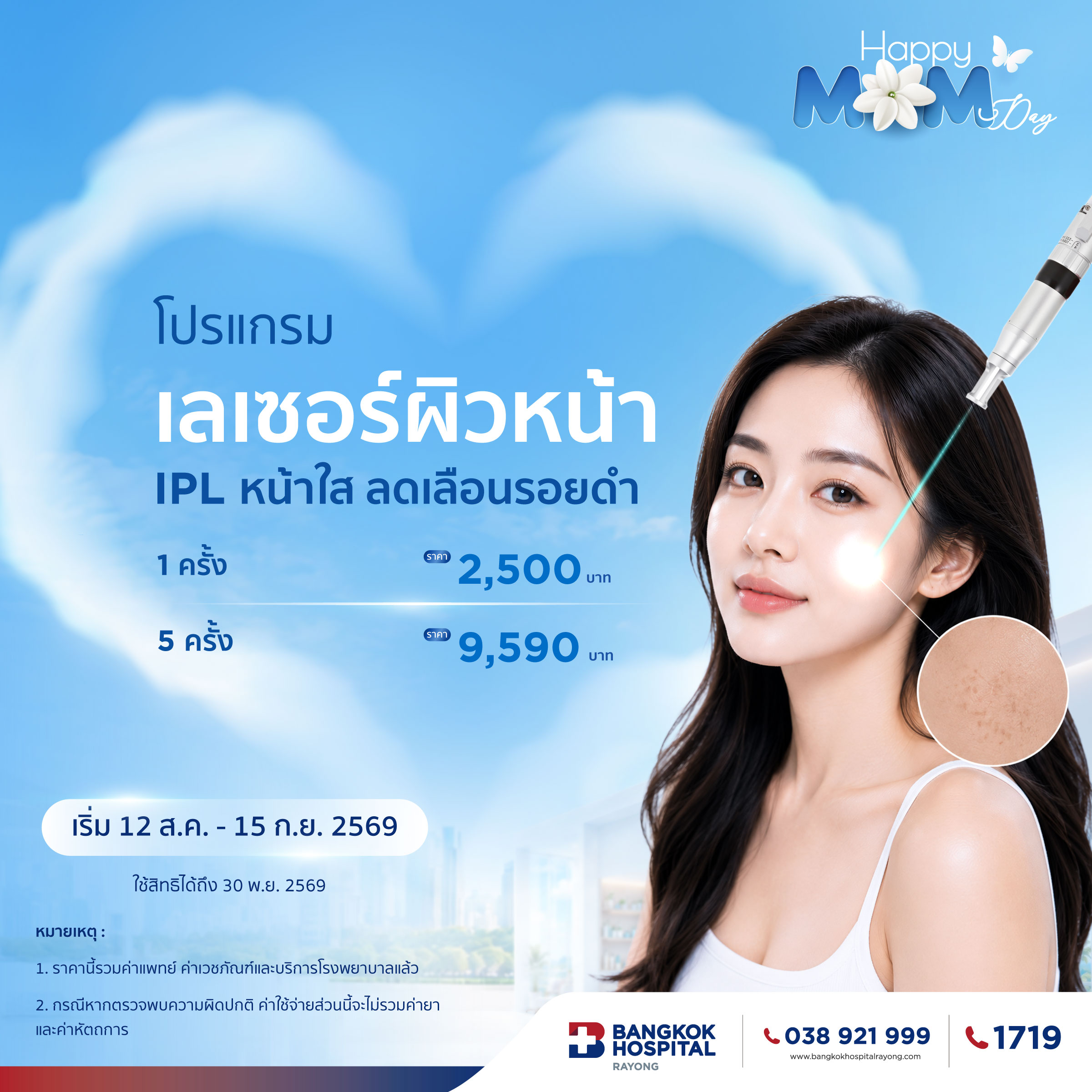 Promotion Happy Mom Day Beauty 5 โปรแกรมเลเซอร์ผิวหน้า IPL 5 ครั้ง